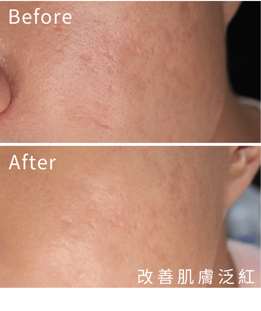 簡單保養B5修護乳_BA.1