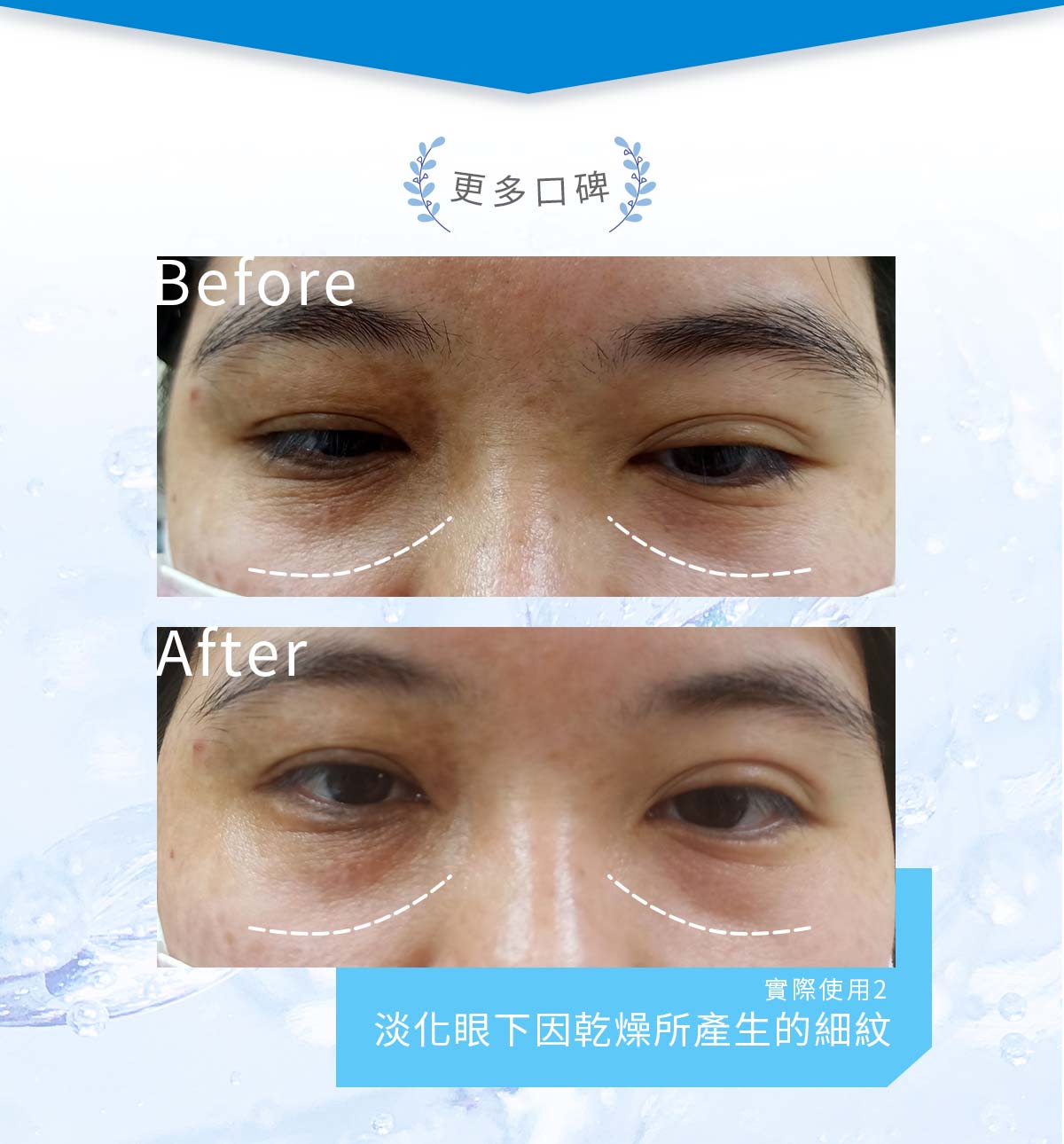 簡單保養B5修護乳_BA.2