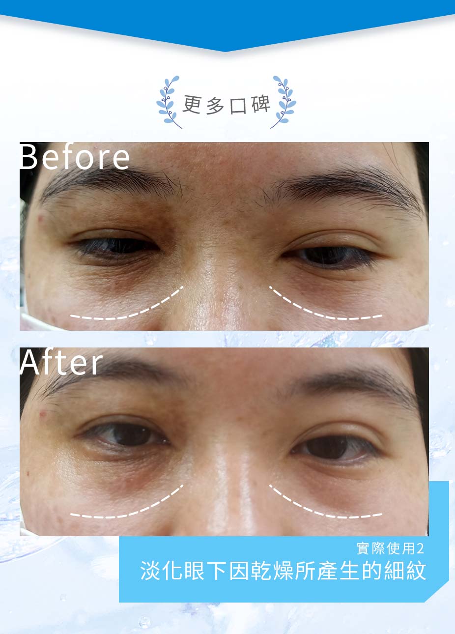 簡單保養B5修護乳BA.2